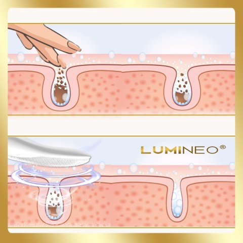 LUMINEO LUMINEO Professional Line Szczoteczka do twarzy Sonic Thermo Brush + Żel Lumineo do skóry delikatnej i wrażliwej